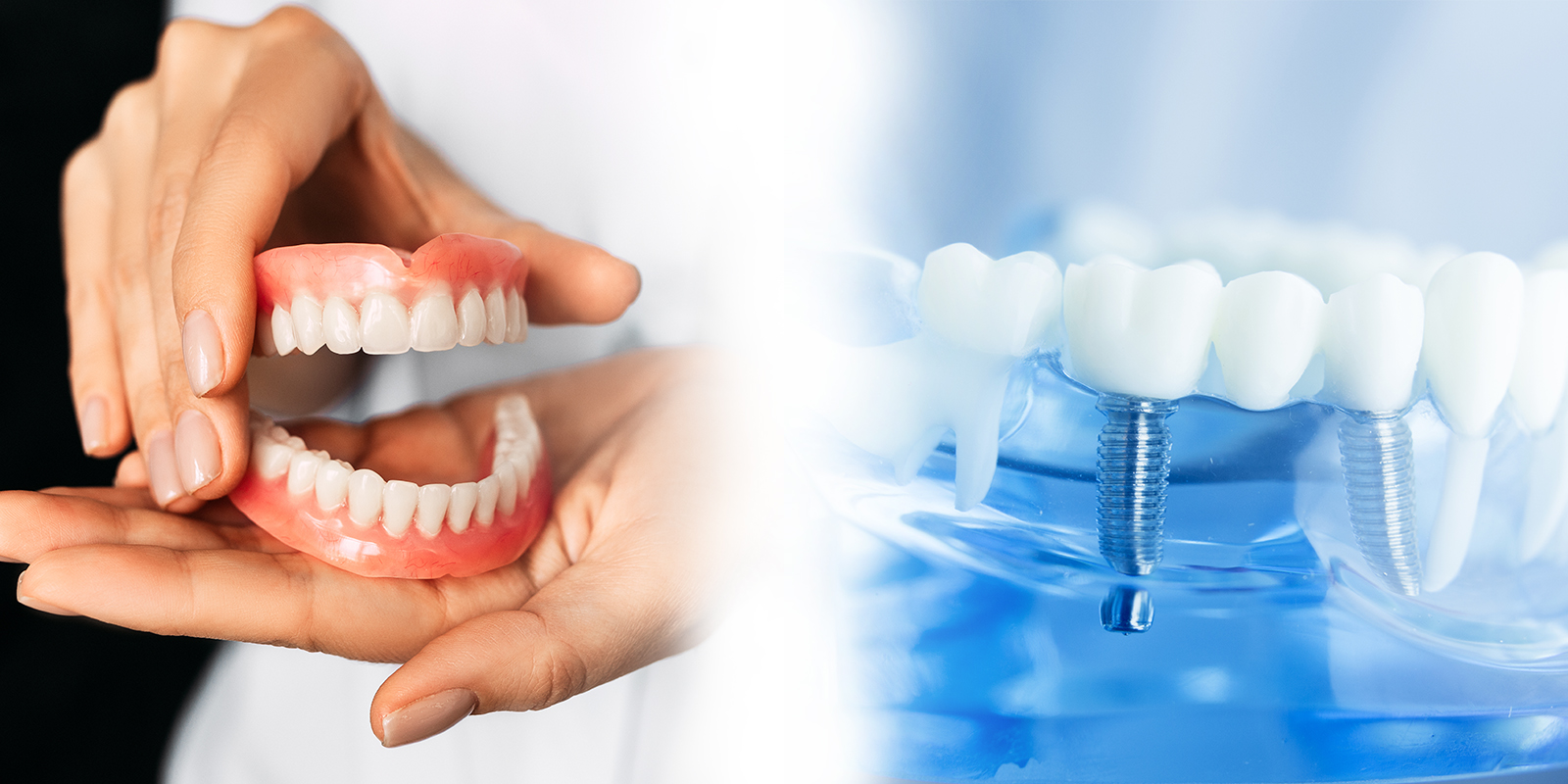 入れ歯とインプラントの違いについて